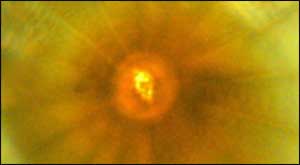 a hydrogen sample while being squeezed in the diamond anvil cell