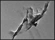 Transmission electron microscope (TEM) image