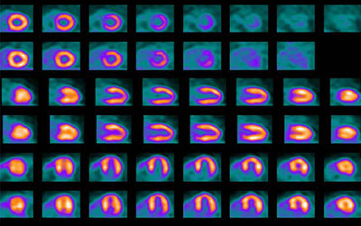 photo of heart imaging