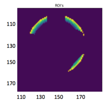 rings function