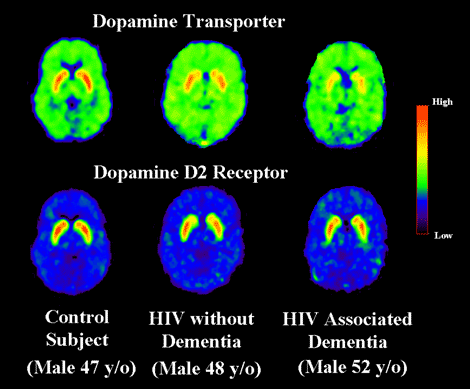 Brain images
