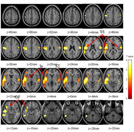 Image of brain scans