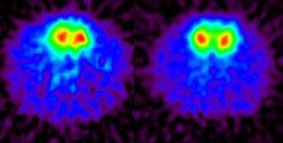 Brain scan image