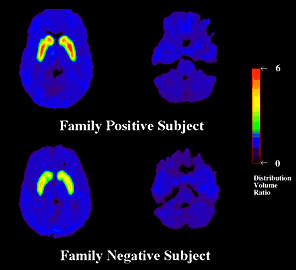 Brain scan image