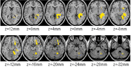 Brain images