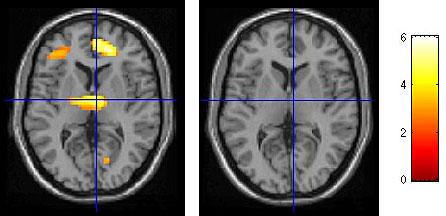 Photo of brain scans