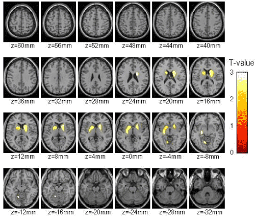 Brain images
