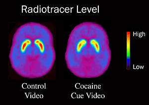 Image of brain dopamine levels