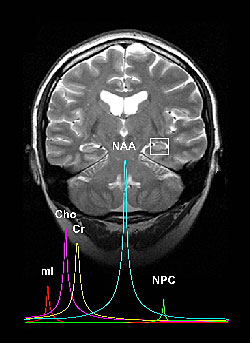Brain Image