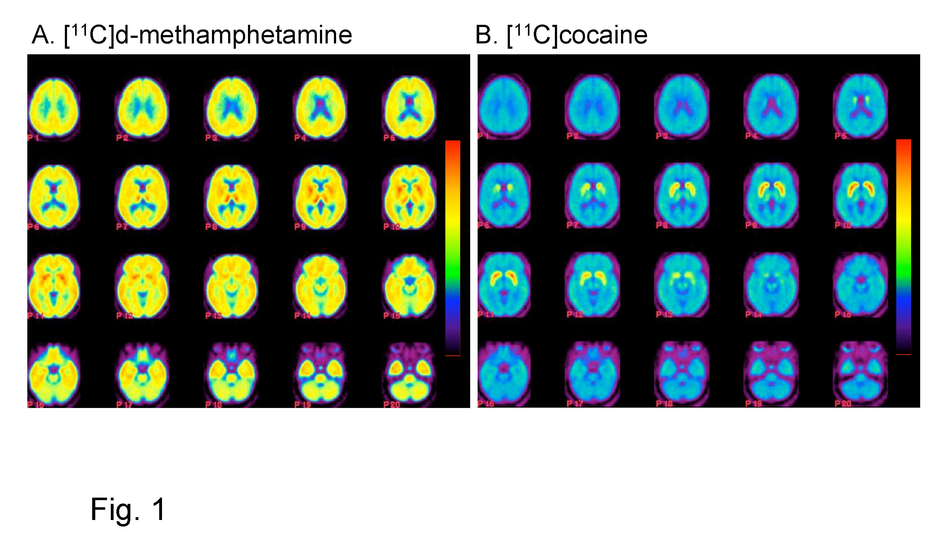 Methamphetamine Enters Brain Quickly And Lingers BNL Newsroom methamphetamine-enters-brain-quickly-and-lingers-bnl-newsroom