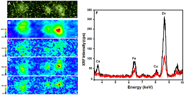 Thioflavin S-stained PSAPP mouse brain tissue