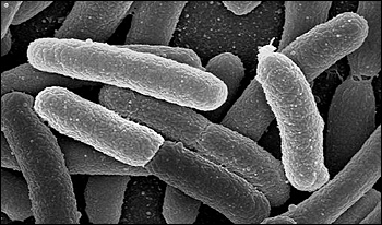 Several E. coli cells