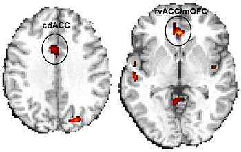 Ritalin improves brain function