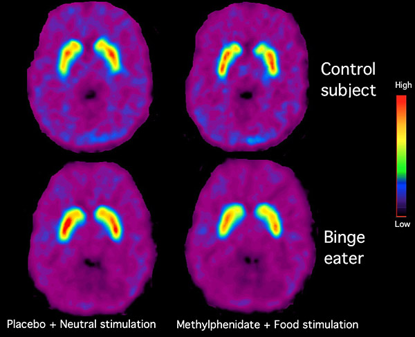 brain scans