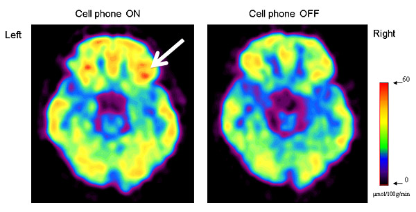 cell phone brain scans