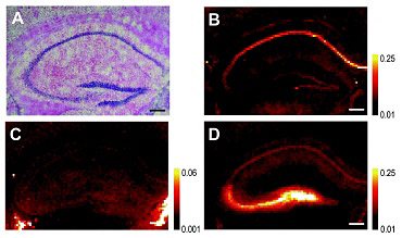 stained hippocampal brain section