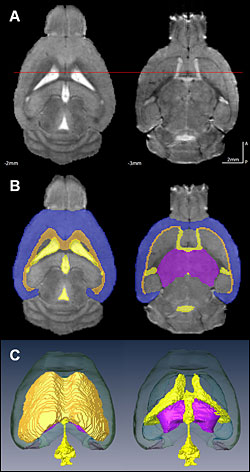 brain volume