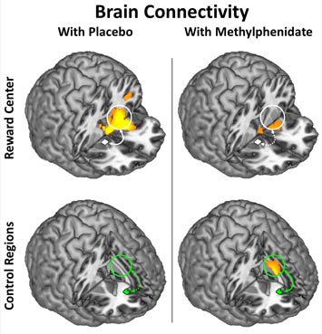 brain areas