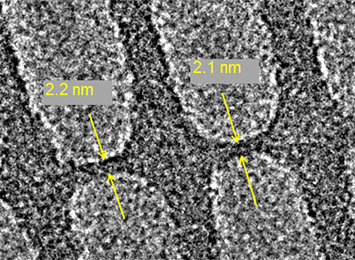 Electron microscopy image