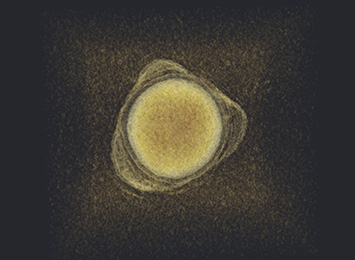 Golden Nanoparticle
