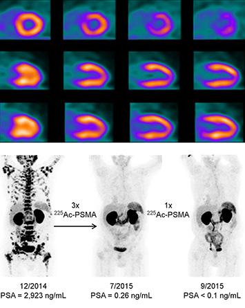 Medical applications of isotopes produced at BLIP