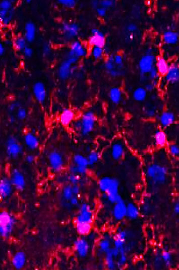 Healthy microglia in mouse brain