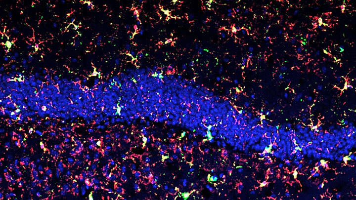 Reactive microglia in irradiated mouse hippocampus.