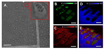 XRF images