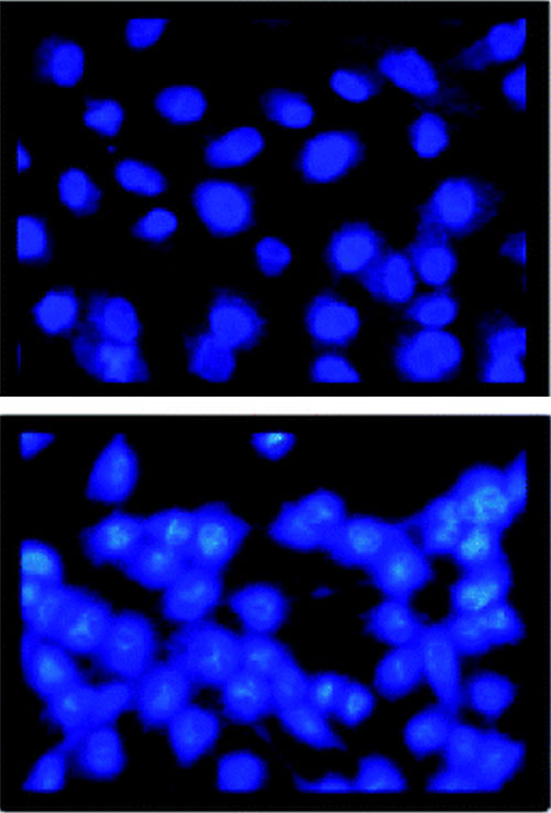 Optical microscopy images of cancer cells