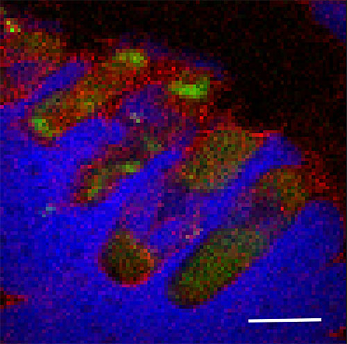 x-ray fluorescence map