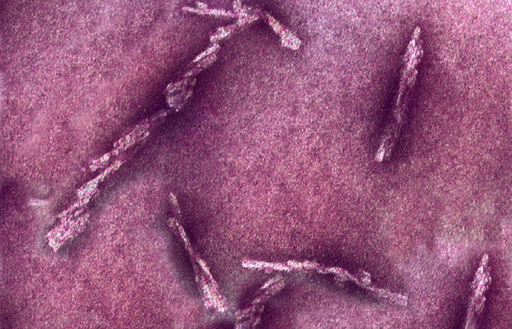 Photo of prions