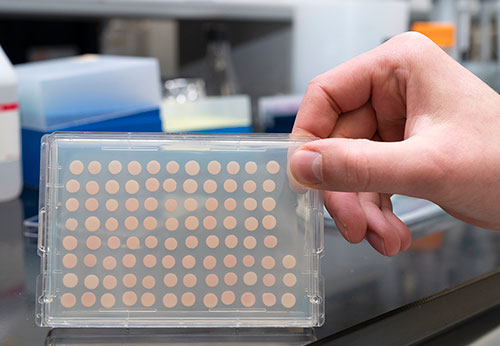 Closeup photo of a sample plate filled with yeast cell cultures used in these studies