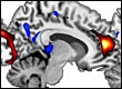 brain scan