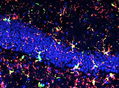 Reactive microglia in irradiated mouse hippocampus