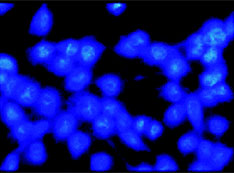 Optical microscopy images of cancer cells