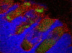 x-ray fluorescence map