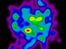 Image of heavy nuclei