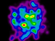 models of proton and neutron arrangement