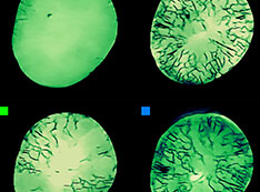 Progression of cracks shown across four green particle images