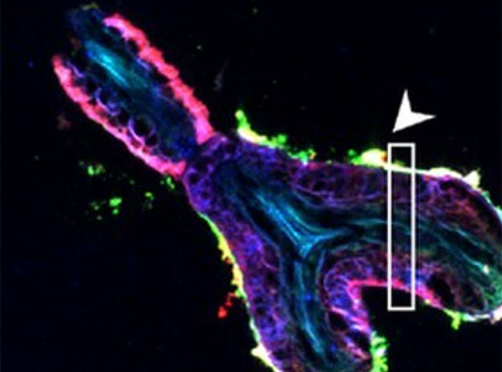 Element-specific SXRF images of calcium (Ca), copper(Cu), Fe(iron), and zinc (Zn)